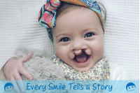 Cleft Lip and Palate Association